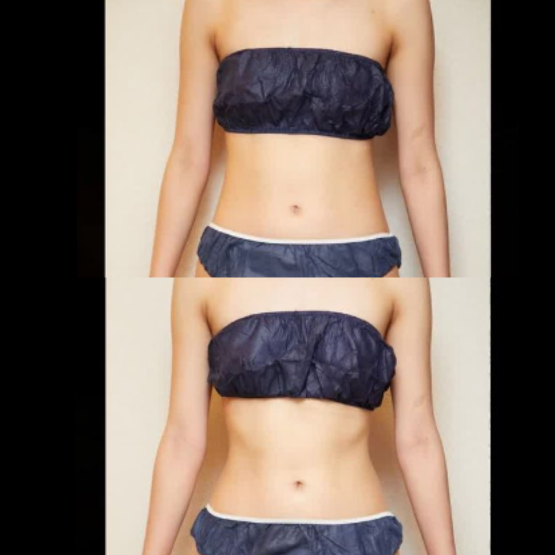 beforeとafterの施術の変化